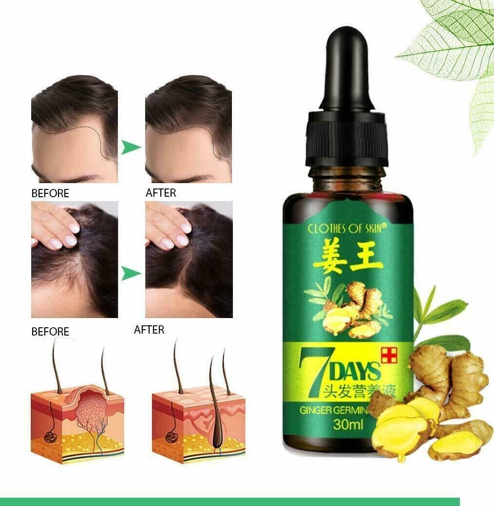 7 Days Hair Growth Serum Oil | Ginger Germinal Hair Regrowth Essence (3 x 30ml Bottles)