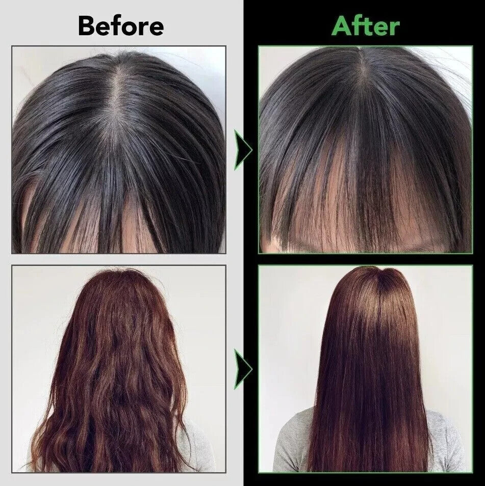 Aliver Jamaican Black Castor Oil Shampoo 300ml | Promotes Hair Growth & Strengthens Hair & Scalp