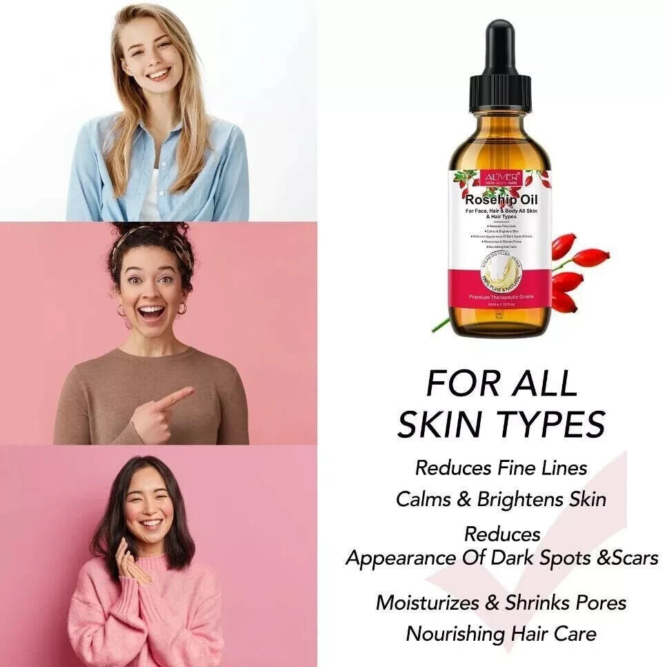 Aliver 100% Pure Rosehip Oil 60ml | Cold-Pressed Natural Oil for Radiant Skin & Healthy Hair