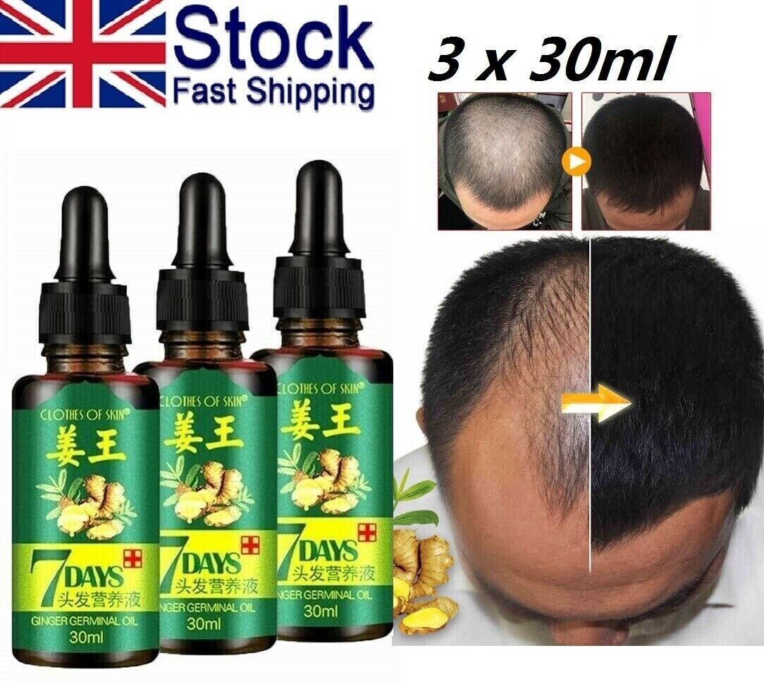 7 Days Hair Growth Serum Oil | Ginger Germinal Hair Regrowth Essence (3 x 30ml Bottles)