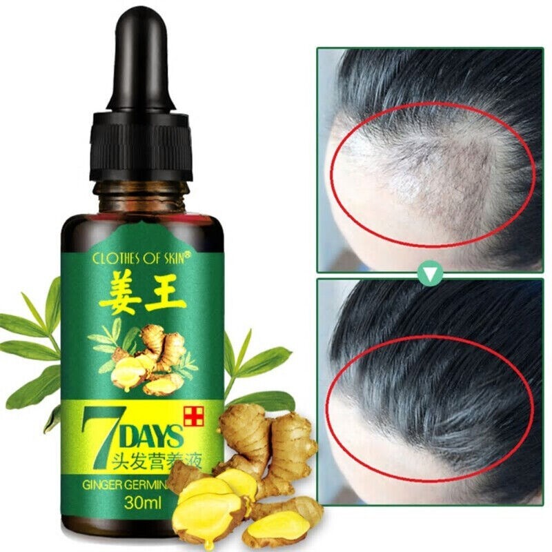 7 Days Hair Growth Serum Oil | Ginger Germinal Hair Regrowth Essence (3 x 30ml Bottles)
