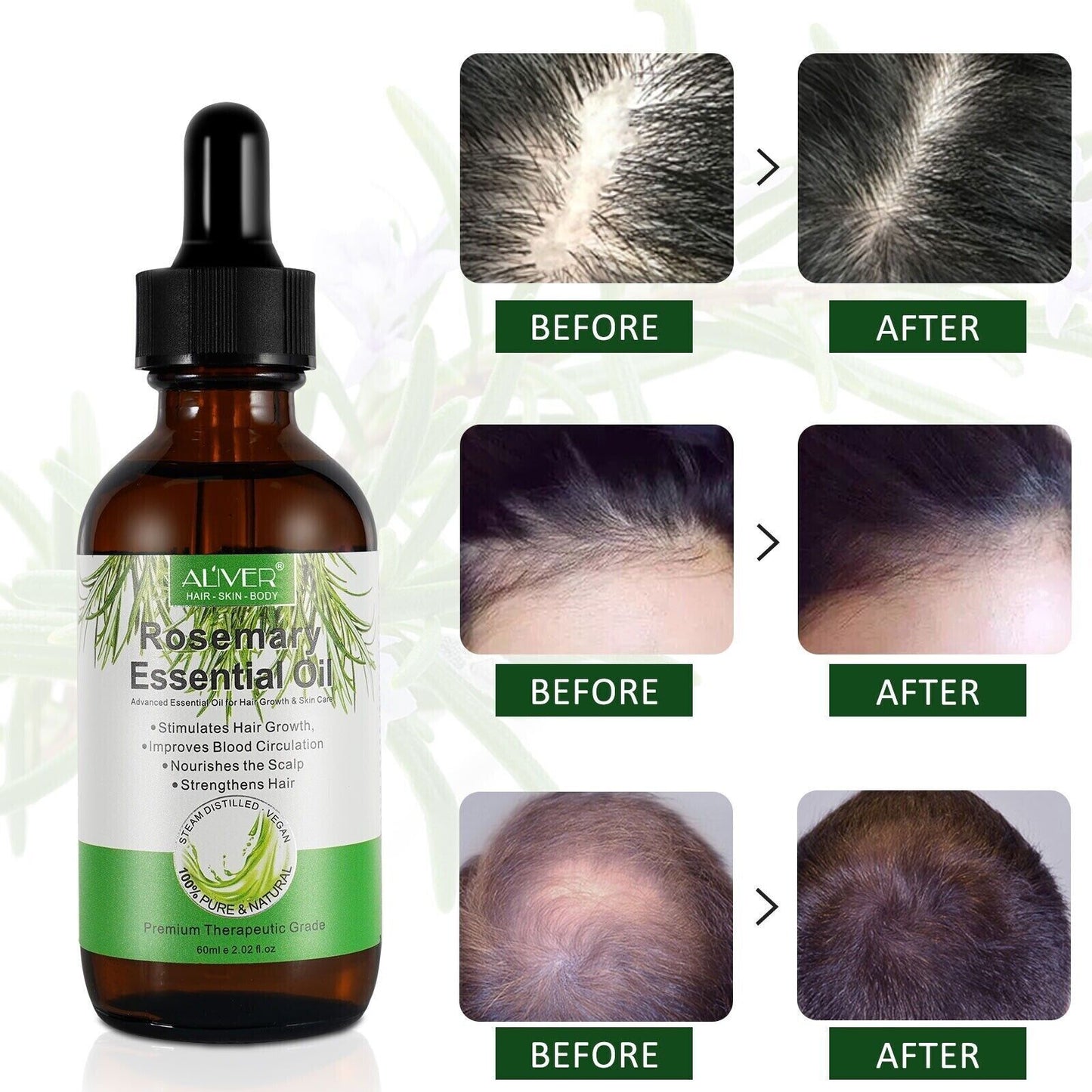 Aliver Rosemary Hair Growth Oil 120ml | Natural Hair Regrowth & Strengthening Treatment
