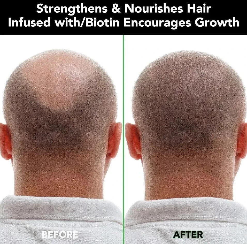 Aliver Jamaican Black Castor Oil Shampoo 300ml | Promotes Hair Growth & Strengthens Hair & Scalp