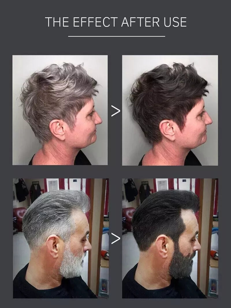 Sevich Instant Hair Dye Black Shampoo | Fast Grey/White Coverage & Moisturising Hair Care (250ml)